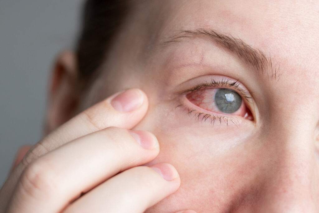 sensitive eyes 