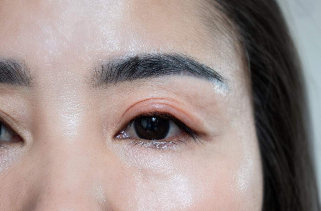 learn how preservative-free compounded eye drops are better 