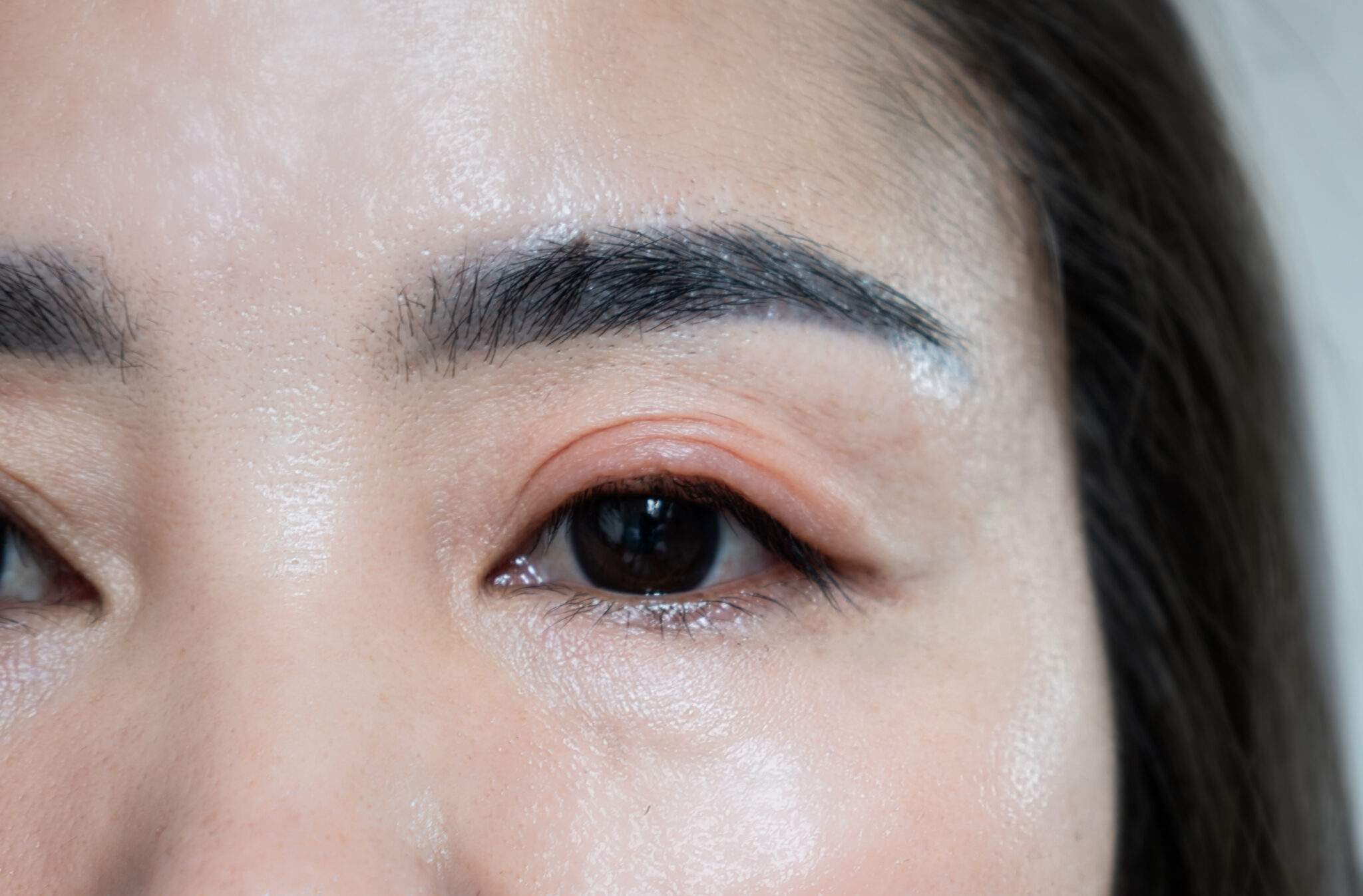 Why Preservative-Free Compounded Eye Drops Are Better for Sensitive ...